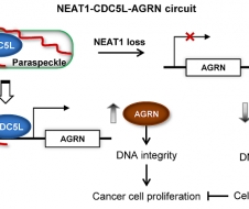 杨雪瑞研究组提出长非编码RNA NEAT1在前列腺癌中的促癌作用新机制
